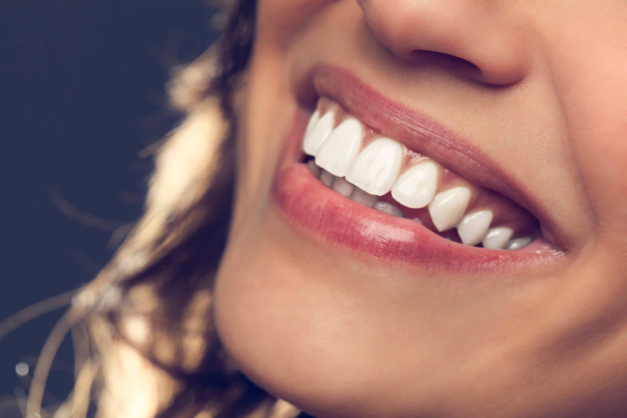 Como Ter Um Sorriso Perfeito Veja Dicas Para Arrasar Odontocompany